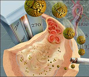 colesterol Diabetes