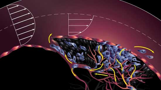 Descubren el enigma de las metástasis 17